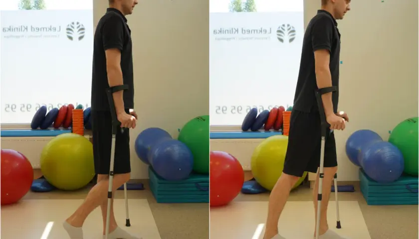 Jakie ćwiczenia po złamaniu kłykcia pomogą w szybszej rehabilitacji?